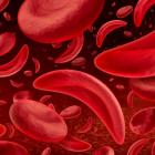 Gene therapy uptake in sickle cell stays slow, despite patient interest