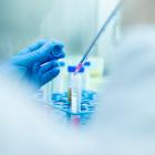 Teva to collaborate with Fosun Pharma for TEV-56278