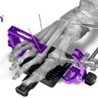 Paragon 28 Announces First Cases and Limited Market Release of the Bun-Yo-Matic™ – A Next Generation Clamp and Cut Guide System for Lapidus Bunion Procedures