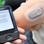DexCom Stock Rises as Glucose Monitoring System Gets FDA Clearance