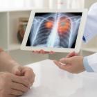 Genprex dosing subjects in trial of combination therapy for small-cell lung cancer