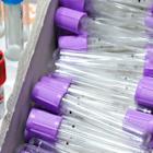 Insider Stock Buying Reaches US$860.4k On DENTSPLY SIRONA