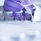 Those who invested in Exelixis (NASDAQ:EXEL) three years ago are up 102%