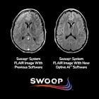 Hyperfine Announces FDA Clearance of Optive AI™ Software, Introducing the Most Substantial Image Quality Improvement Ever for the Swoop® System
