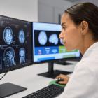 Philips and icometrix advance precision diagnosis in neurology with innovative AI-based imaging solutions at #RSNA24