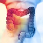 NuCana discontinues Phase II NuTide:323 colorectal cancer study