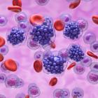 ASCO25: MSD’s ADC candidate achieves 56.3% ORR in lymphoma trial