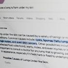 What’s that rash? Put some thought into asking Google for medical help