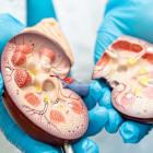 Averoa secures EC authorisation for oral CKD treatment