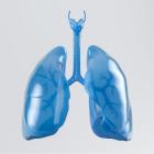 Pharma companies shape competitive pipeline for bronchiectasis