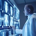 Kura Oncology, Inc. (KURA) and Kyowa Kirin to Present Promising Ziftomenib Data at ASCO 2025