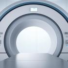 ARAY Stock Falls Despite Positive Data of CyberKnife in Treating BSM