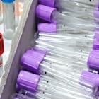 Breakeven On The Horizon For TELA Bio, Inc. (NASDAQ:TELA)