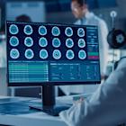 Northwestern Medicine’s AI radiology tool shows enhanced productivity