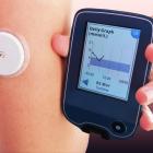 Here's Why You Should Retain DexCom Stock in Your Portfolio for Now