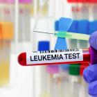 FDA approves Syndax’s Revuforj to treat leukaemia