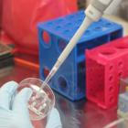 Gilead Sciences (NasdaqGS:GILD) Reveals Promising Phase 3 Trial Results For Trodelvy In mTNBC