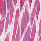 Muscle-sparing obesity drug safe for Phase 3 trial, Veru says