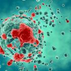 Natera touts positive results for Merkel cell carcinoma surveillance test