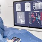 Philips launches intelligent 3D imaging in Europe to empower faster stroke care, helping physicians save time, brain, and lives