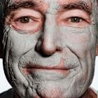 A 70-Year-Old Man’s Search for Younger-Looking Skin