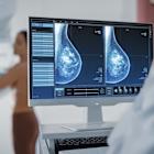 iCAD and Microsoft join forces for AI mammography solutions