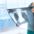 MAIA Biotechnology's Experimental Cancer Drug Shows Tripled Survival Vs. Standard Chemotherapy In Pretreated Lung Cancer Patients