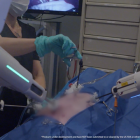 Asensus Surgical Completes In Vivo Surgeon Lab for LUNA Surgical Robotic System