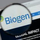 Is the Options Market Predicting a Spike in Biogen (BIIB) Stock?