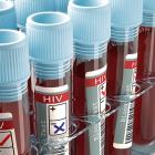 ViiV Healthcare and J&J’s adolescent HIV-1 combo gains EC authorisation