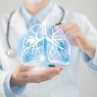 Connect Biopharma begins Phase II trial of drug for acute exacerbations in asthma