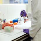 Biotech firm Recursion to buy smaller peer Exscientia for $688 million