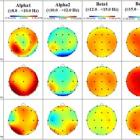 Lipocine Announces Positive Oral Brexanolone Quantitative EEG Results