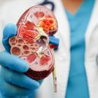 Apellis and Sobi report data from Phase II C3 glomerulopathy trial