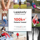 Treace Celebrates 100,000 Lapiplasty® 3D Bunion Correction® Patient Milestone