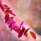 Sickle cell patient dies in Beam study of base editing therapy