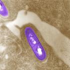 Listeria outbreak linked to prepared foods now recalled hospitalizes 10