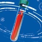 New Tests Promise to Reveal the Secrets in Your Blood