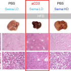 Tiziana Life Sciences Announces Positive Results from Ozempic and Nasal Anti-CD3 Combination Study