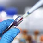 Labcorp Launches Molecular Residual Disease and Liquid Biopsy Solutions