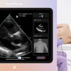 HeartFocus Unveils AI-powered Education App for Conducting Clinical-Grade Heart Scans, Available on Butterfly Network’s Handheld Ultrasound Devices