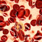 For Patients With Rare Blood Cancer, New Drug Offers Relief