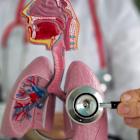 Viatris gains China approval for Yupelri to treat COPD