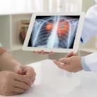 First subject dosed in Revolution Medicines’ Phase III NSCLC treatment trial