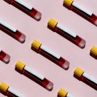 Freenome posts pivotal liquid biopsy data as FDA filing nears completion