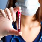 DGX Stock Gains Following the Launch of New AD-Detect Blood Test