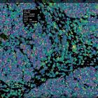 Bruker Spatial Biology Pushes Boundaries in Spatial Biology and Multiomics at AACR 2025