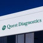 Take the Zacks Approach to Beat the Markets: ADMA Biologics, Limbach, Quest Diagnostics in Focus